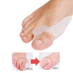 Pack Of 4 Pairs Silicone Gel Foot Fingers Hole Bunion Toe Separator Thumb Valgus Protectors - Image 5