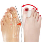 Pack Of 4 Pairs Silicone Gel Foot Fingers Hole Bunion Toe Separator Thumb Valgus Protectors