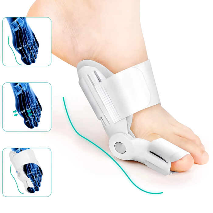Bunion Splint and Big Toe Straightener – Orthopedic Hallux Valgus Corrector for Foot Pain Relief & Pedicure Care - Image 1