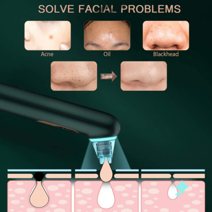 Turata USB Rechargeable Blackhead Remover Advanced Pore Vacuum With 3 Different Suction Levels - Image 5