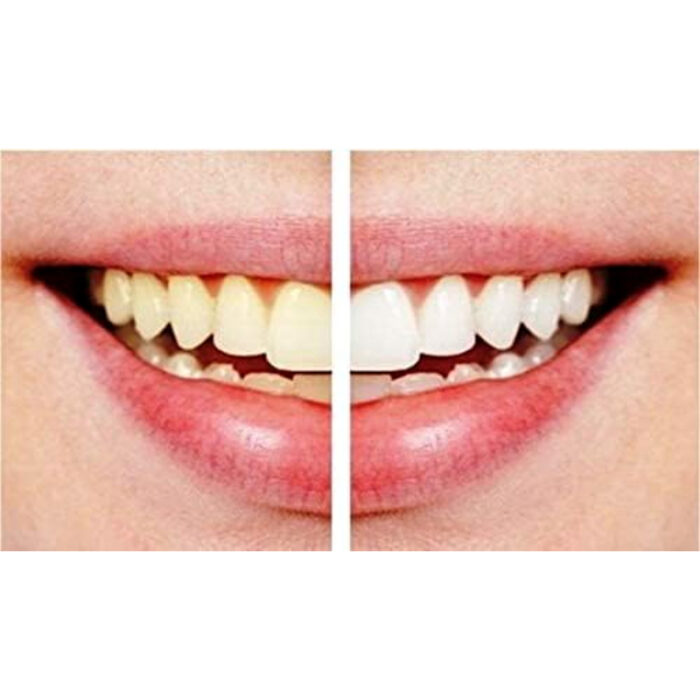 Pack Of 2 Dazzling White Hygienic Professional Strength Teeth Whitening Pens - Image 3