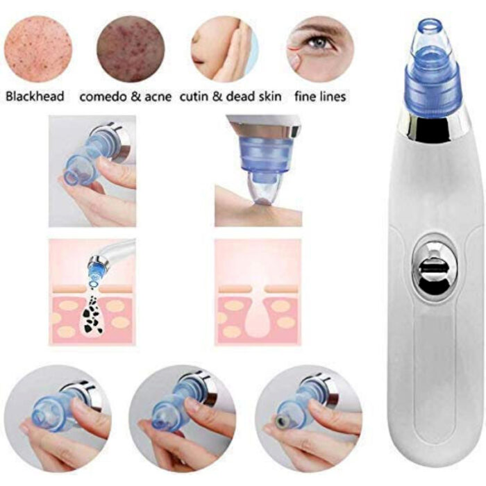 DermaSuction Vacuum Pore Cleaning Device With 4 Interchangeable Suction Heads - Image 6