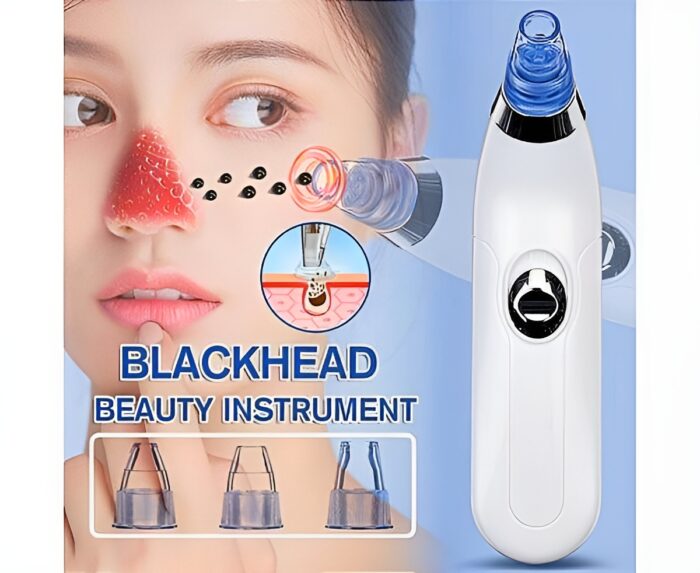 Derma Suction Blackheads Remover  3 In 1 Black Head Remover Machine-Acne Pimple Pore Cleaner Vacuum Suction Tool (Cell Operated) - Image 1