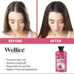 Wellice Onion Anti Hair Loss Oil - 150ml - Image 5