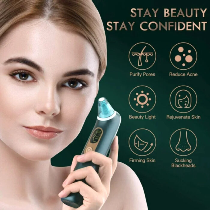 Turata USB Rechargeable Blackhead Remover Advanced Pore Vacuum With 3 Different Suction Levels - Image 4