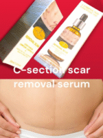 Acne Scar Removal Rejuvenation Serum | Scar, C section & Stretch Mark Removal Oil for women - Image 12