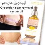 Acne Scar Removal Rejuvenation Serum | Scar, C section & Stretch Mark Removal Oil for women - Image 13