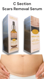 Acne Scar Removal Rejuvenation Serum | Scar, C section & Stretch Mark Removal Oil for women - Image 14