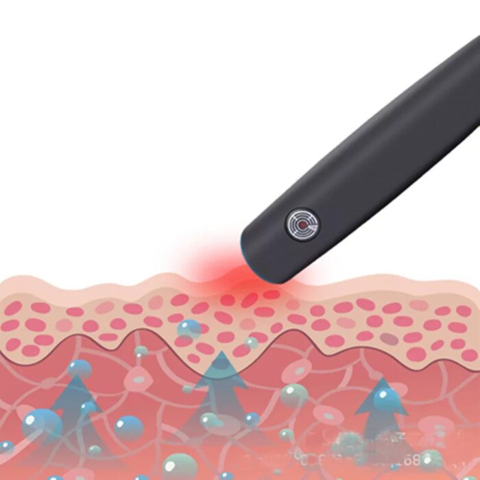 Mosquito Bite Helper – Insect Bite Relief, Useful For Summer, Helps Children, Insect Bites, Adults, Irritation, Itching, Neutralizer, Relieve Stings (Cell operated ) - Image 9