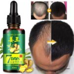 original 7 Days Hair Growth Germinal Serum Oil (30ML)