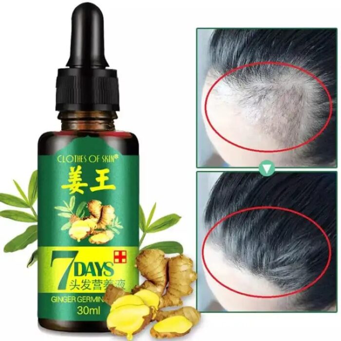original 7 Days Hair Growth Germinal Serum Oil (30ML) - Image 4