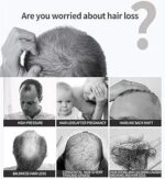 Original Growth Hair Oil Spray Repair Follicles Strengthen Hair Root DHT Blocker Nourishing 30ml - Image 3