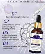 Aichun Beauty Medical Formula Anti-Acne Whitening Facial Serum-30ML - Image 3
