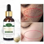 100% original Aichun Anti Freckle Whitening Facial Serum 30ml