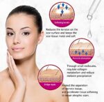 AICHUN BEAUTY Scar Removal Facial Serum Pimples Stretch Marks Face Moisturizing Body Remove Scars Kojic Acid Vitamin E 30ml - Image 7