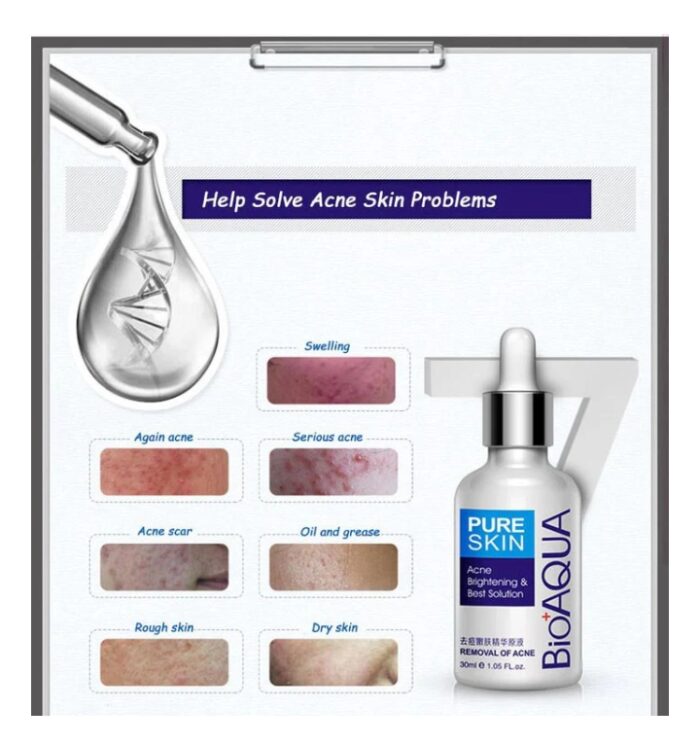 Bioaqua Anti-Acne Serum Removal Of Acne Essence Liquid 30ML - Image 3