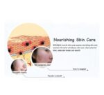 Bioaqua Anti-Acne Serum Removal Of Acne Essence Liquid 30ML - Image 6