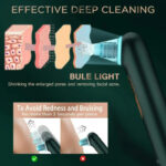 Turata USB Rechargeable Blackhead Remover Advanced Pore Vacuum With 3 Different Suction Levels - Image 9