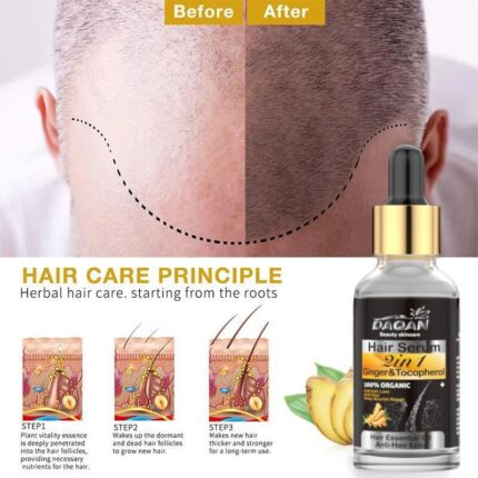Anti Hair Loss Serum 2 in 1 Natural Hair Fall Serum Ginger and Tocopherol Hair Growth Essence Oil Hair Care Serum | Hair Loss Treatment for Men & Women |