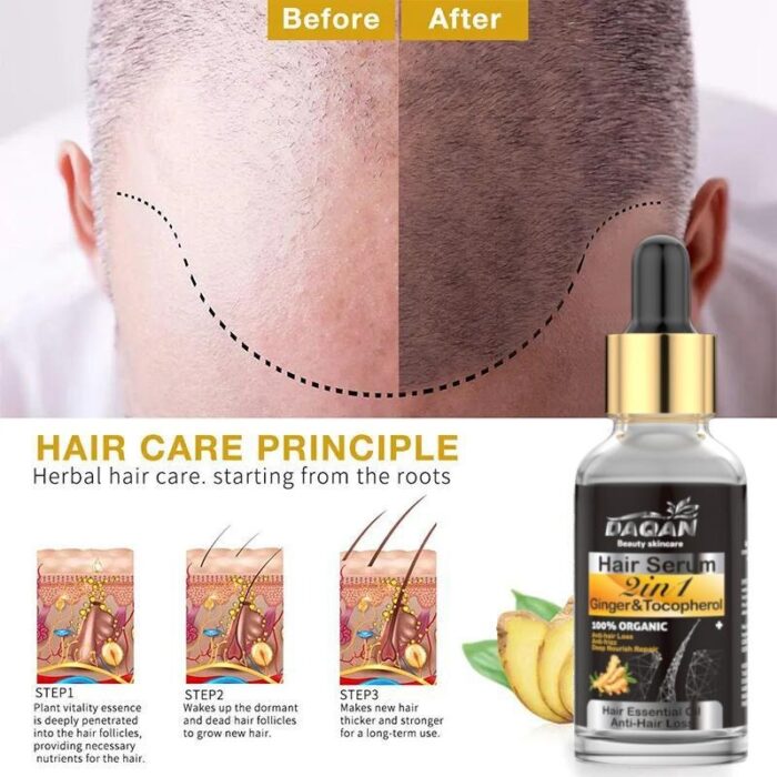 Anti Hair Loss Serum 2 in 1 Natural Hair Fall Serum Ginger and Tocopherol Hair Growth Essence Oil Hair Care Serum | Hair Loss Treatment for Men & Women | - Image 1