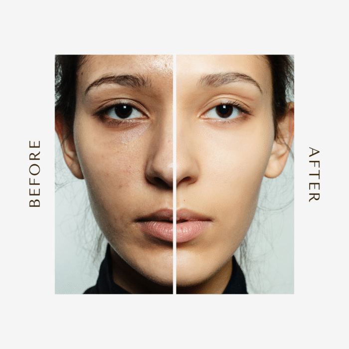 Glow natural Glutathione Alpha Arbutin Skin Brightening Cream (50g) - Image 4