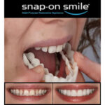 Pack Of 2 Pairs Snap-On Smile Custom Fit Perfect Smile Veneers In 3 Easy Steps - Image 10